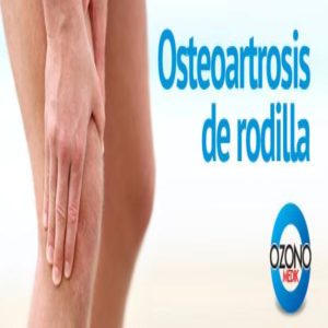dolor de rodilla